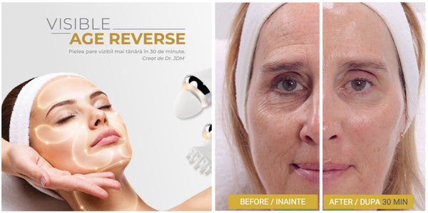 Rejuvenate at Spa Metisse with first professional neurocosmetic treatment in Romania